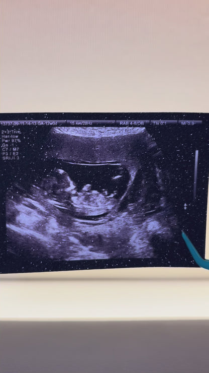 Timeless Sparkling Sonogram Print