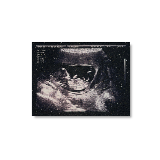 Timeless Sparkling Sonogram Print